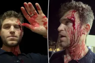 Keegan Allen shares graphic video after armed robbery at West Hollywood grocery store