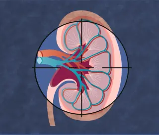 Finerenone extends kidney protection to non-diabetic CKD, early FIND-CKD data show
