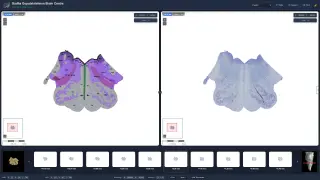 India Unveils the Most Detailed Brainstem Map Ever