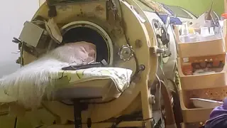 Final U.S. polio iron-lung survivor dies at 78 in Oklahoma