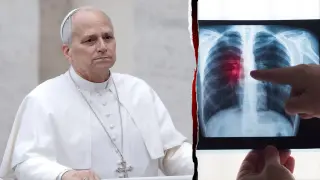 Pope Leo XIV’s Lung Cancer Diagnosis Raises Questions on Papal Travel and Non-Smoker Risks