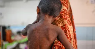 Bangladesh fights a deadly measles surge as vaccination gaps widen