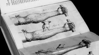 Beyond the Machine: why the body can't be reduced to parts