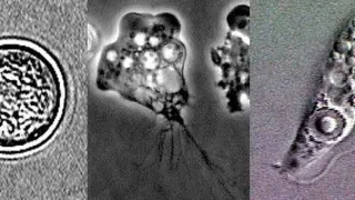 NC Teen Dies After Rare Brain-Eating Amoeba Infection