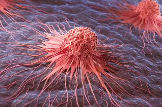 Cancer-fighting Strategy: Turning Iron-Heavy 'Zombie' Cells Against Their Tumors