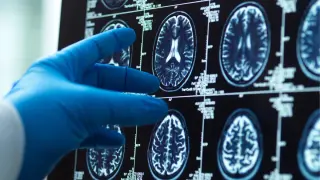 WHO outlines life-course plan to prevent nearly half of dementia cases