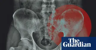 Experts debunk the myth that hips specifically store emotional trauma