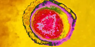 Exosome clues link shingles-related chronic pain to new treatment targets