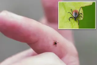 China reports new tick-borne virus ALTNV linked to flu-like illness