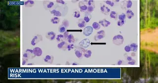 Heat-Driven Spread Expands Brain-Eating Amoeba Risk in North Carolina