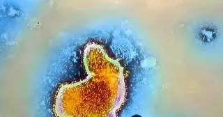 Rare Brain-Eating Amoeba Claims North Carolina Teen