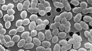 Sugar intake during antibiotic use accelerates gut microbiome collapse, study finds