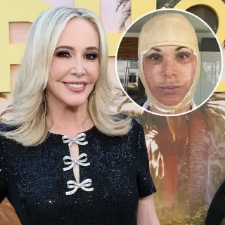 Shannon Beador Claps Back with Hilarious Shade on Alexis Bellino's Facelift