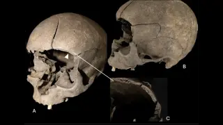 Archaeologists uncover child's skull embedded in 2,500-year-old Scandinavian house floor
