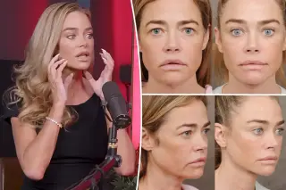 Denise Richards Details Full Facelift One Year On