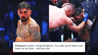 Topuria Eyes Rematch After Gaethje KO with Reports of Double Vision