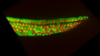 Israeli study identifies rare cochlear cells with potential to reverse hearing loss