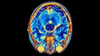 Two Developmental Tracks Forge the Human Brain, New Study Finds