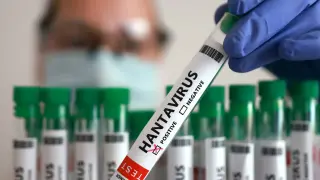 Hantavirus spreads mainly by close contact, not airborne, officials say