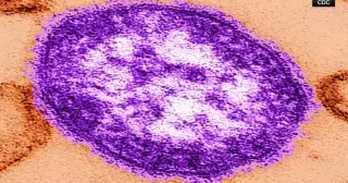 Allegheny County school linked to two measles cases as Pennsylvania outbreak accelerates