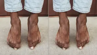 Toe Hair: A Subtle Health Clue Hidden On Your Feet