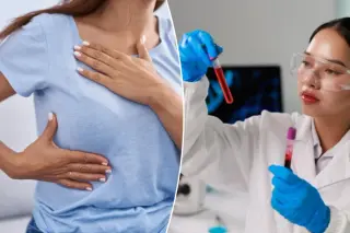 Outdated BRCA tests and age limits may miss thousands of cancer risks