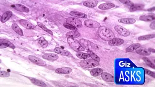 Could Shingles Vaccination Slow Dementia?