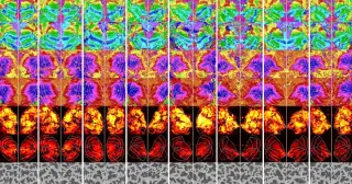 Brain-IT AI Reconstructs Visual Thoughts from Brain Scans in One Hour