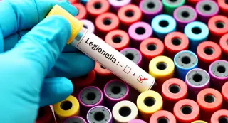 Upper East Side Legionnaires cluster triggers cooling-tower testing