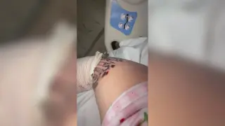 Instagram tattoo from online artist leads Arizona woman to hospital with severe infection