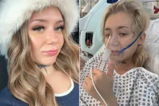 From Teenage Vaping to Terminal Lung Cancer: 22-Year-Old Faces 18-Month Prognosis