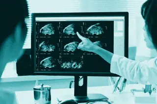 Why doctors are not yet routinely offering fallopian tube removal to prevent ovarian cancer