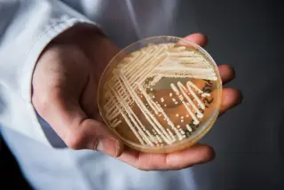 Candida auris detected across 27 states: key facts for the public