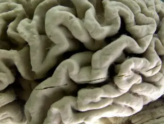 UCSD study maps a molecular switch to prevent Alzheimer’s in mice