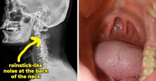 64 Real-Life Medical Mysteries That Prove the Body Is Full of Surprises