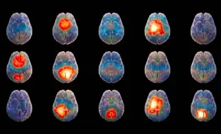 Israel AI Startup Promises 15-Minute Brain Disorder Diagnosis