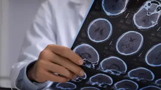 WHO adds seven dementia risk factors, widening prevention focus