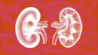 HHS Unveils Kidney Care Plan to Break Dialysis Monopoly