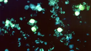 EBV-driven immune cascade linked to MS suggests targeted vaccines