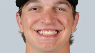Zac Veen Explodes in Triple-A as Rockies Weigh MLB Opportunity