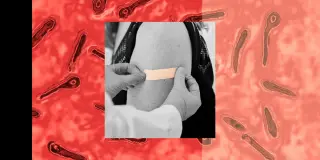 Tetanus Cases Edge Up in the U.S. as Vaccination Gaps Reappear