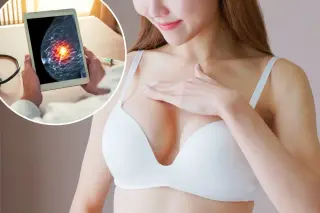 French smart bra uses AI to flag early breast cancer signs