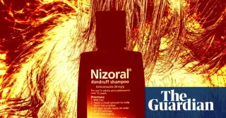 Managing Dandruff: A Guide to Causes, Treatments, and When to Seek Medical Help
