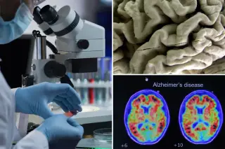 Blood Biomarker Signals Alzheimer’s Risk in Healthy Older Adults