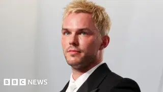 Nicholas Hoult Cast as Gilderoy Lockhart in HBO's Harry Potter Series (Season 2)