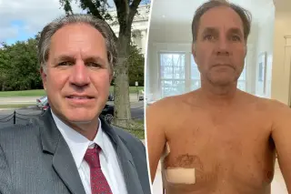 Accidental Prank Leads to Early Detection of Rare Male Breast Cancer