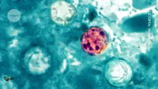 US Records Largest Cyclospora Outbreak as Investigators Hunt the Source