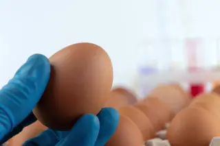 Eating Eggs Daily Could Lower Alzheimer’s Risk, Large Longitudinal Study Finds
