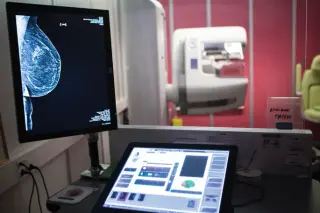 From AI scores to patient outcomes: early lessons on human–AI impact in medicine