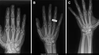 Astronauts Capture Diagnostic X-Rays in Space, Redefining Space Medicine